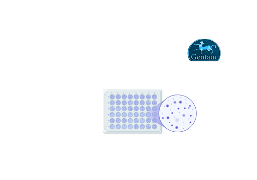 [ESR400G] ELISA Kits SARS-CoV-2 IgG
